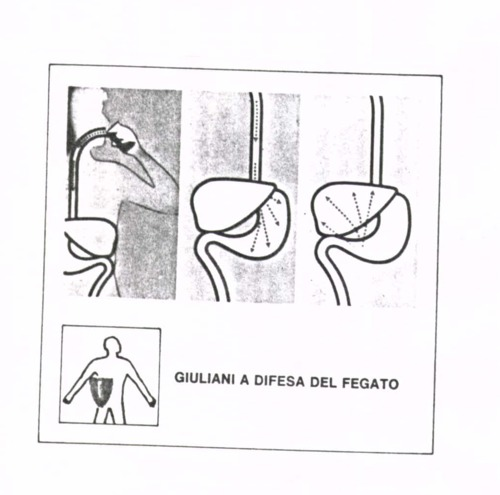 GIULIANI A DIFESA DEL FEGATO