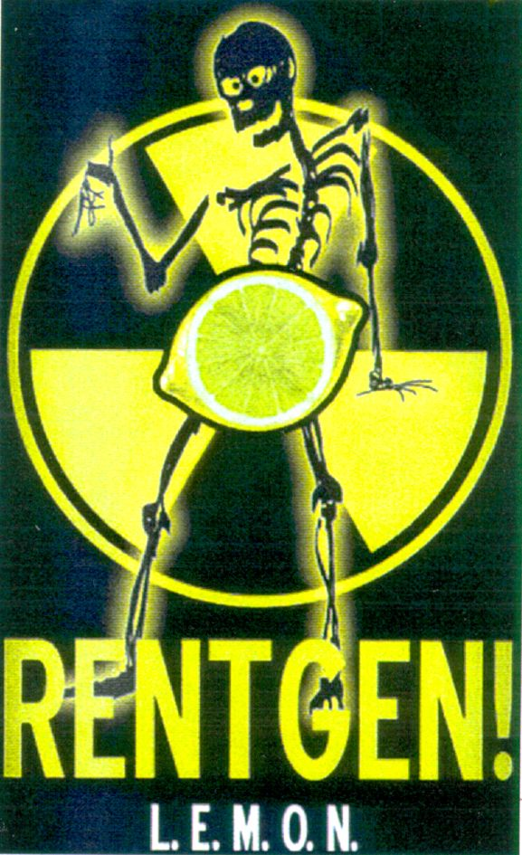 rentgen! l. e. m. o. n.